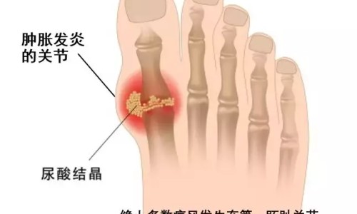 纹眉之后可以出门吗-纹眉期间到底能不能抽烟网 - 为你提供纹眉之后可以出门吗、纹眉的时候可以化妆吗
